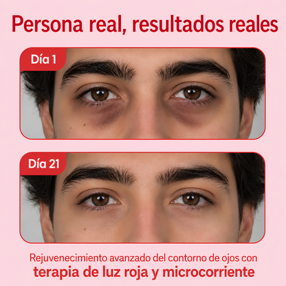 Gafas De Luz Roja y Microcorriente